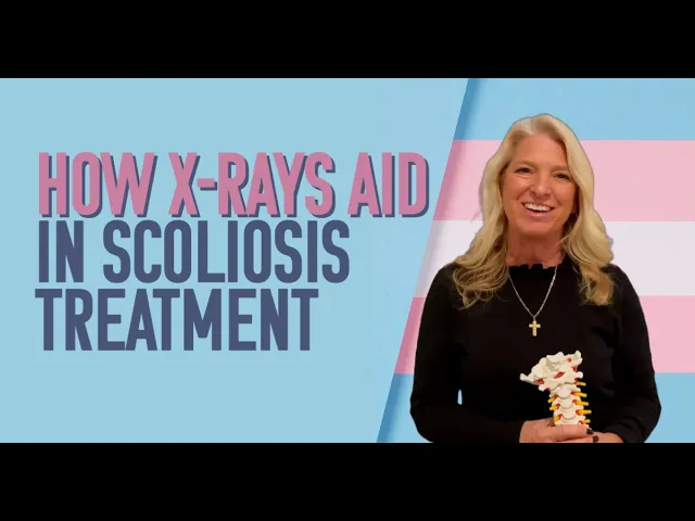 How X-rays Aid in Scoliosis Treatment chiropractor in Jackson Township, NJ